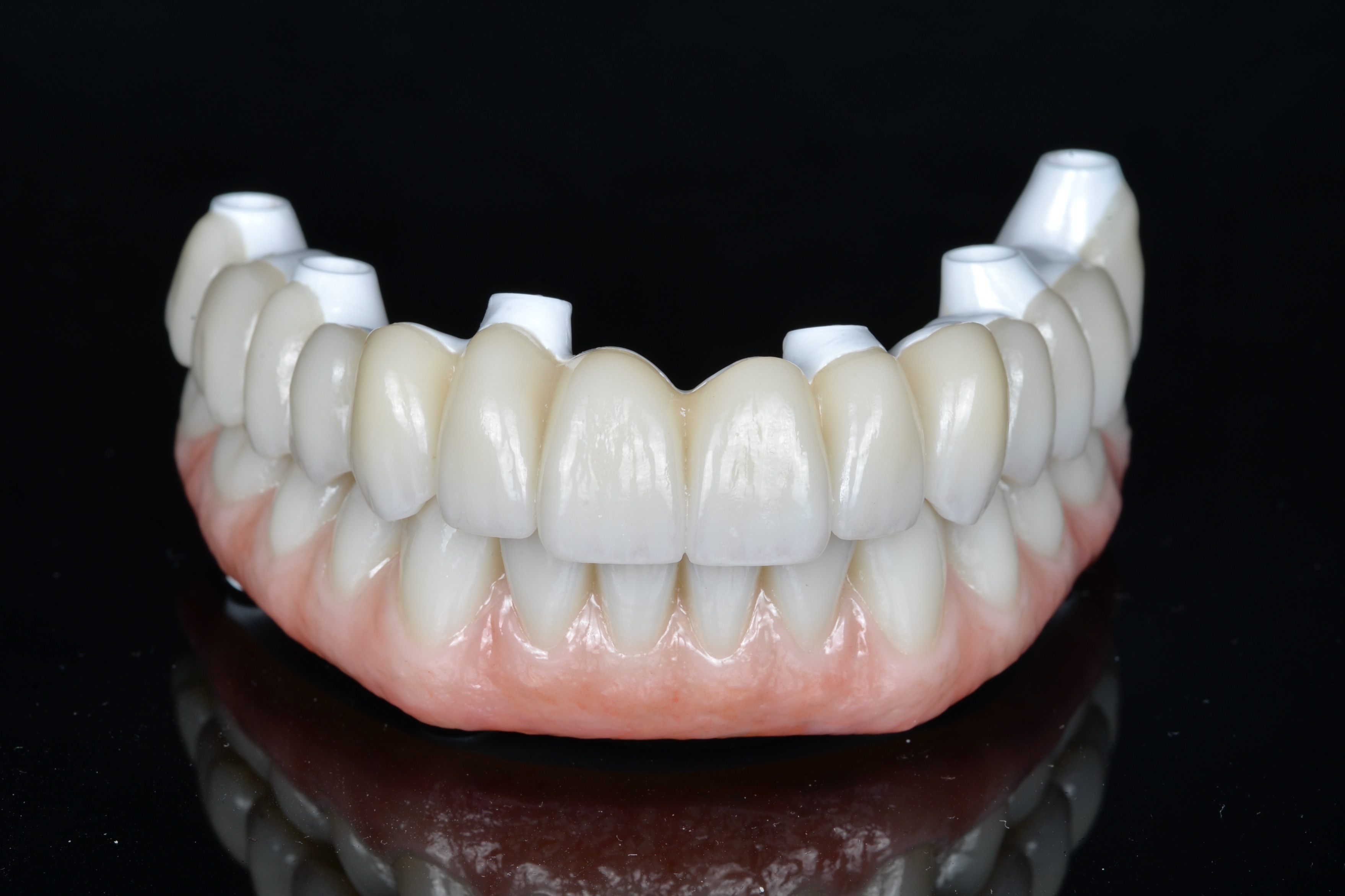 Prótesis de zirconia monolítica
