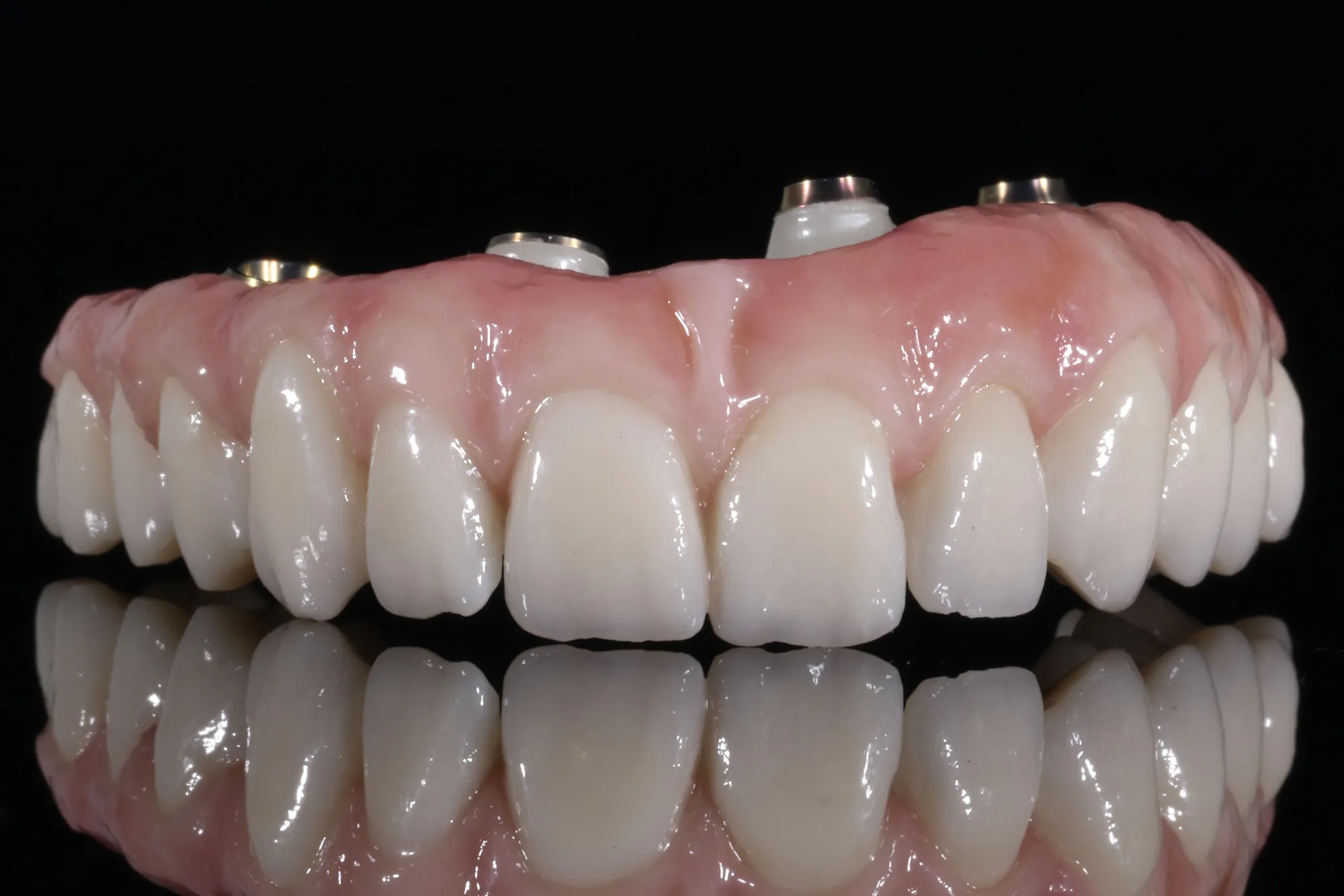 Prótesis de zirconia monolítica