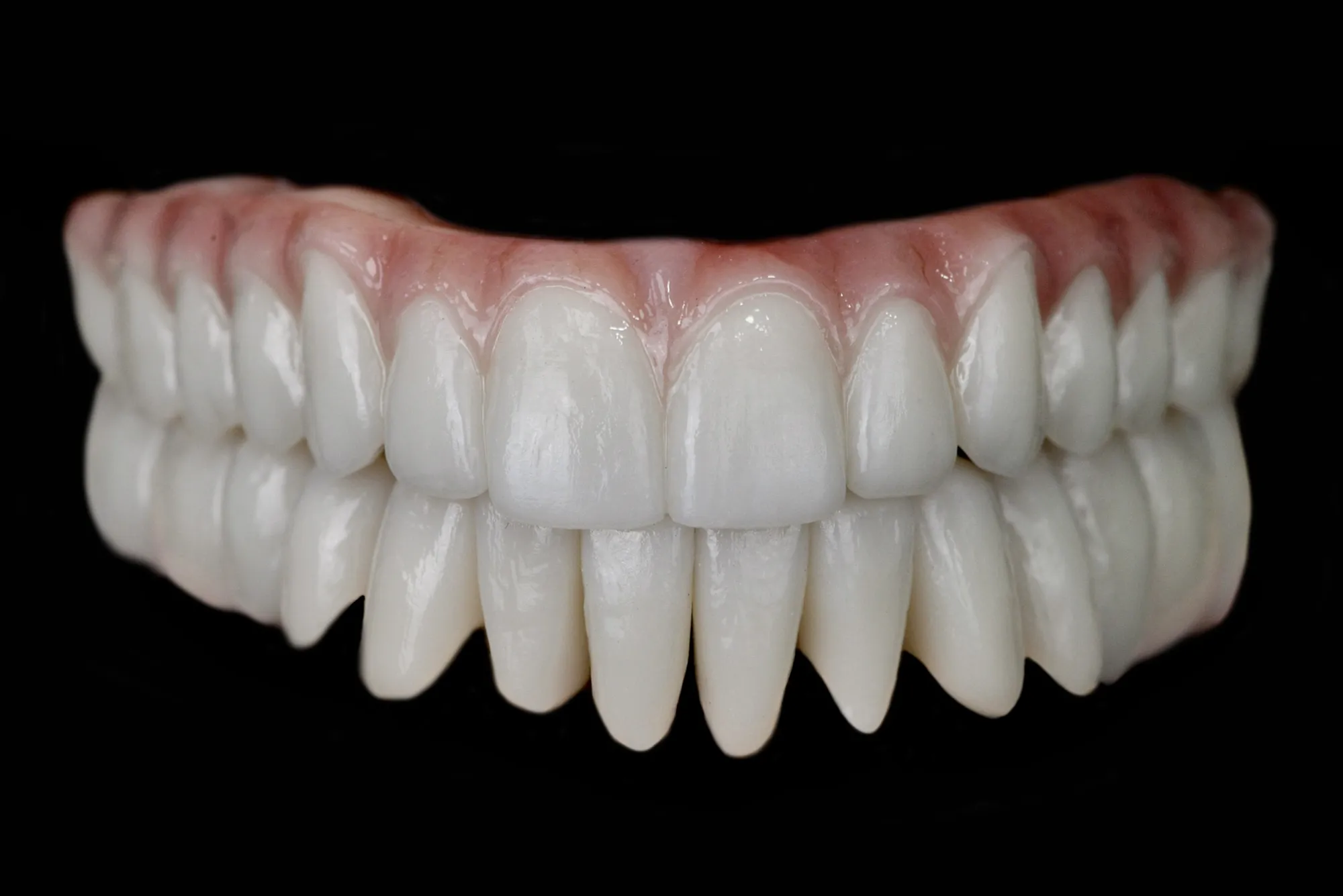 Prótesis de zirconia monolítica