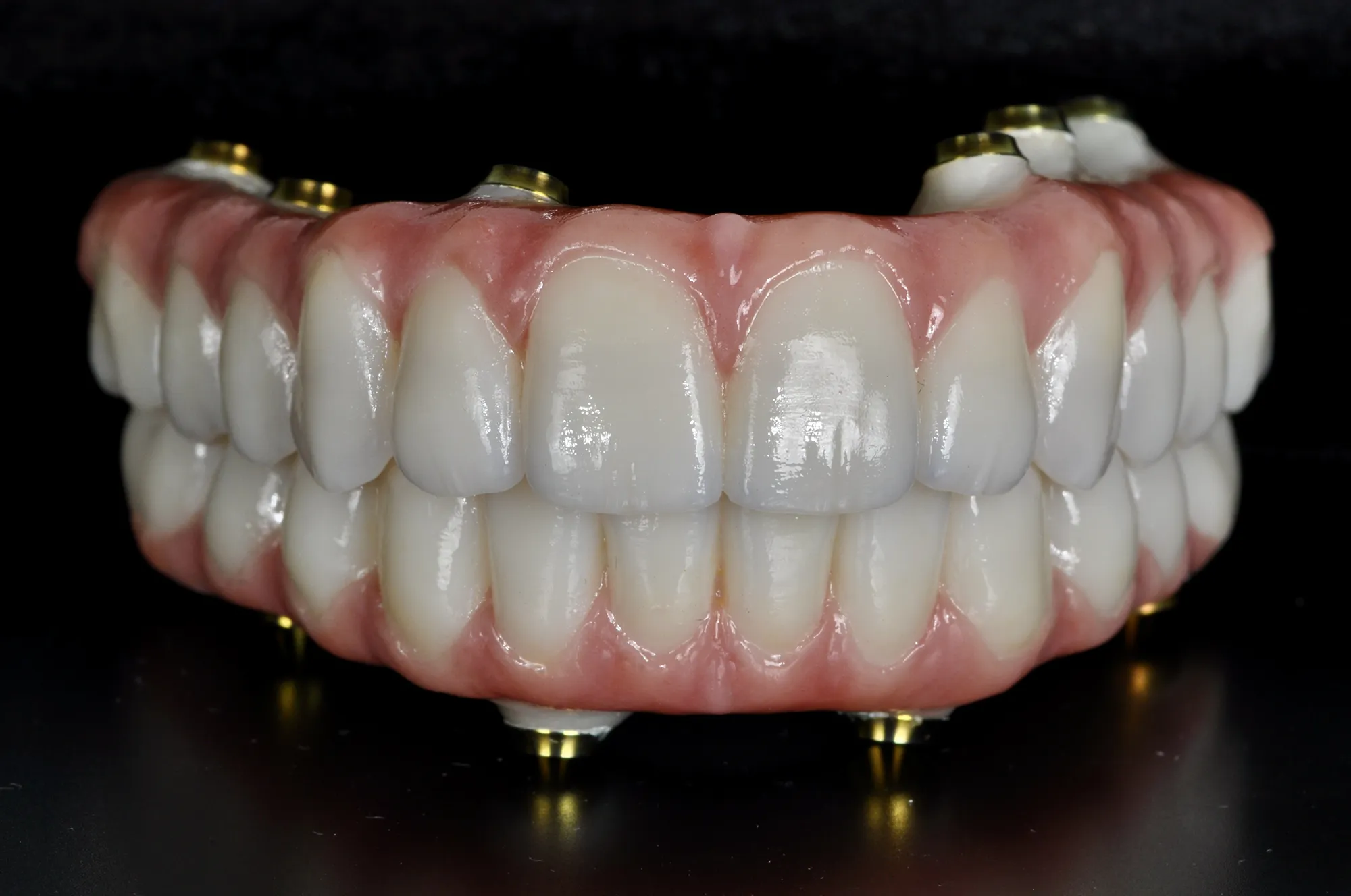 Prótesis de zirconia monolítica