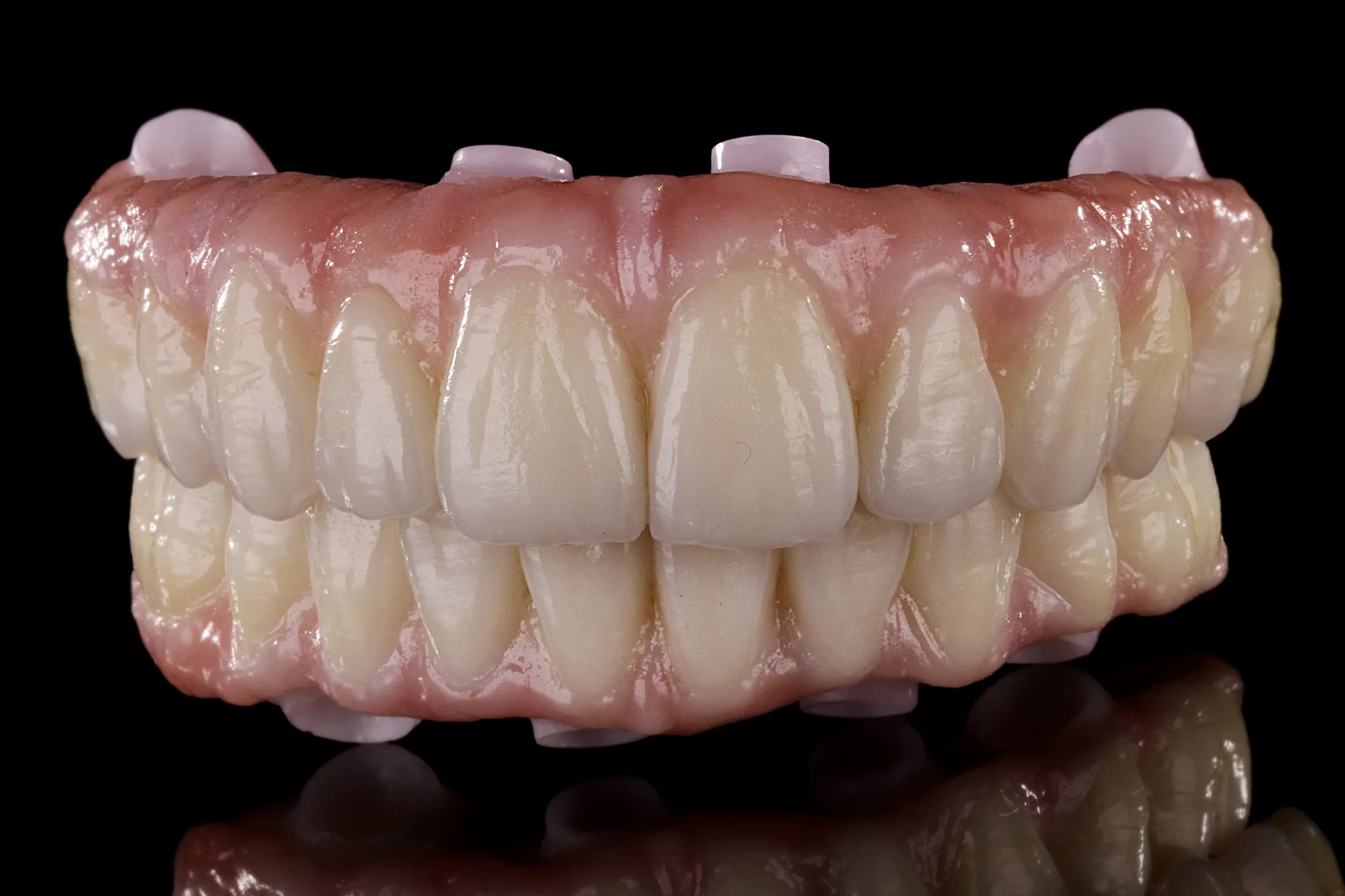 Prótesis de zirconia monolítica