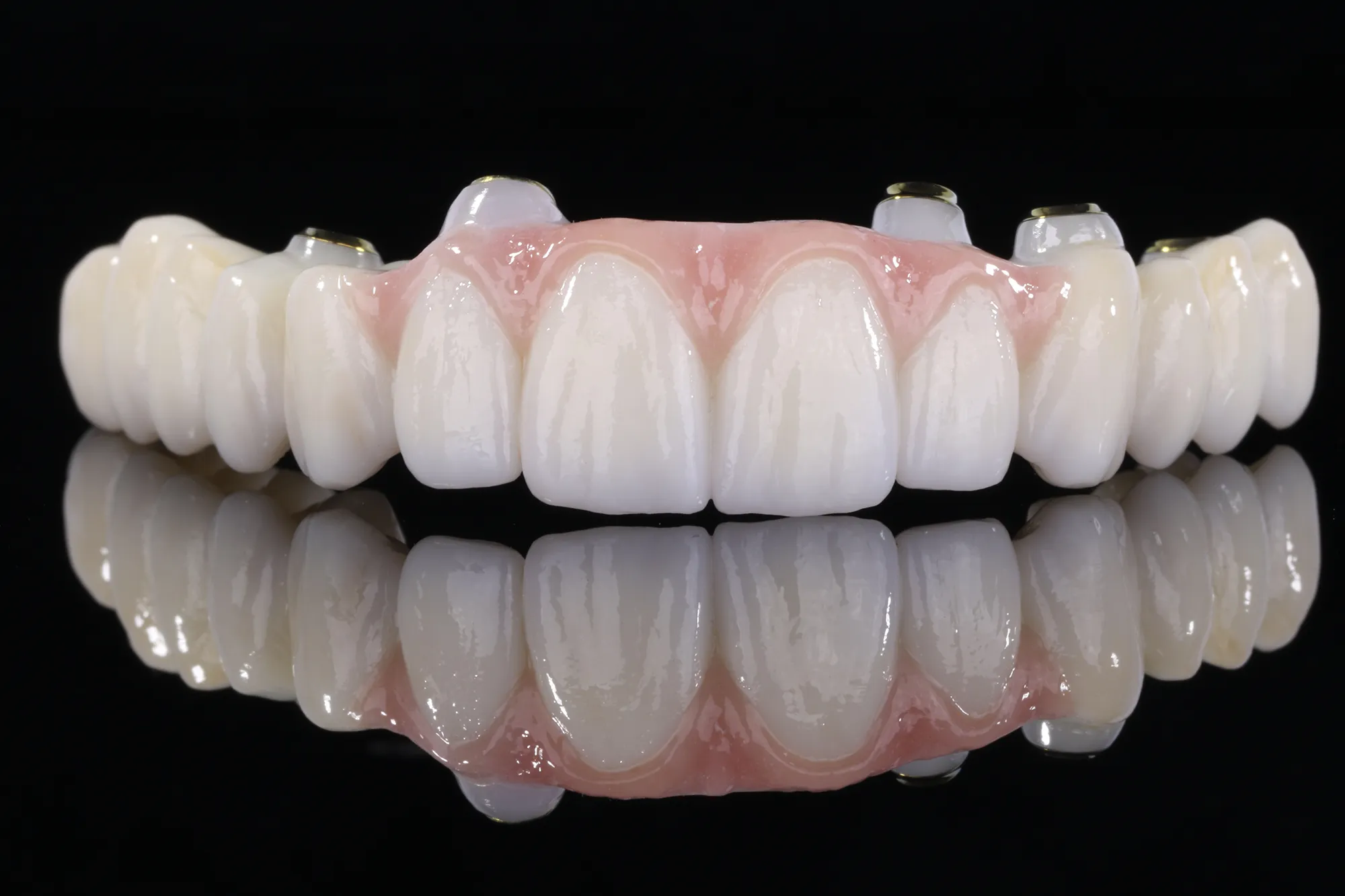 Prótesis de zirconia monolítica