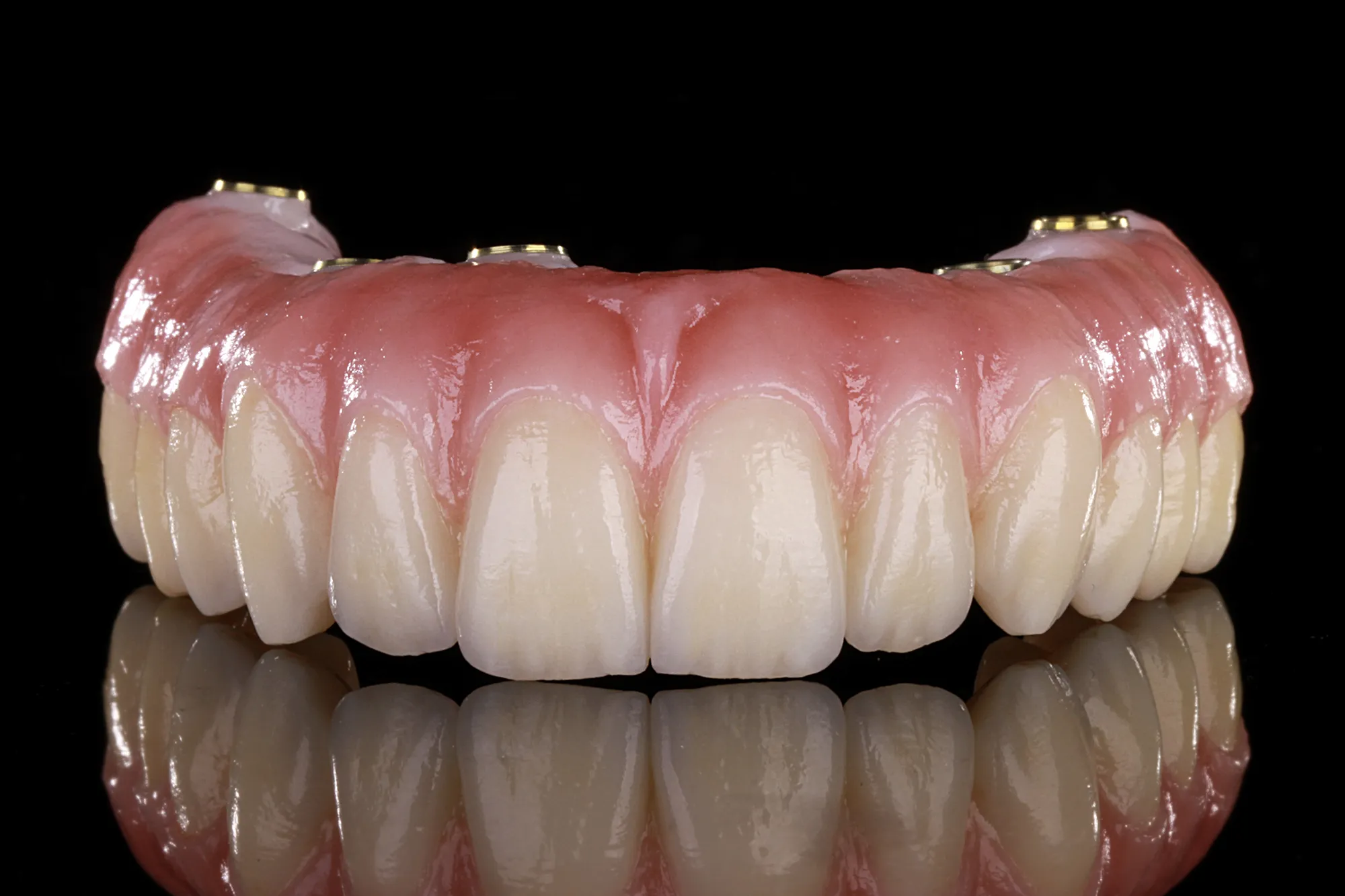 Prótesis de zirconia monolítica
