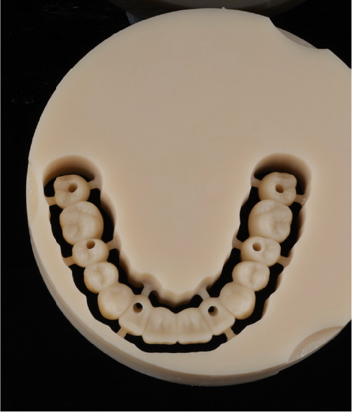 Carga inmediata