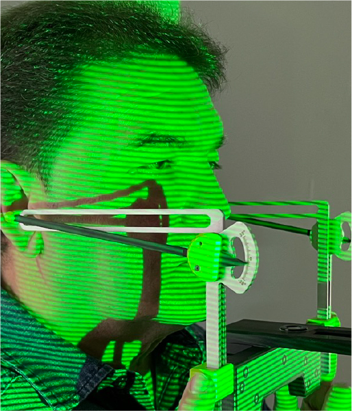 Escáner facial