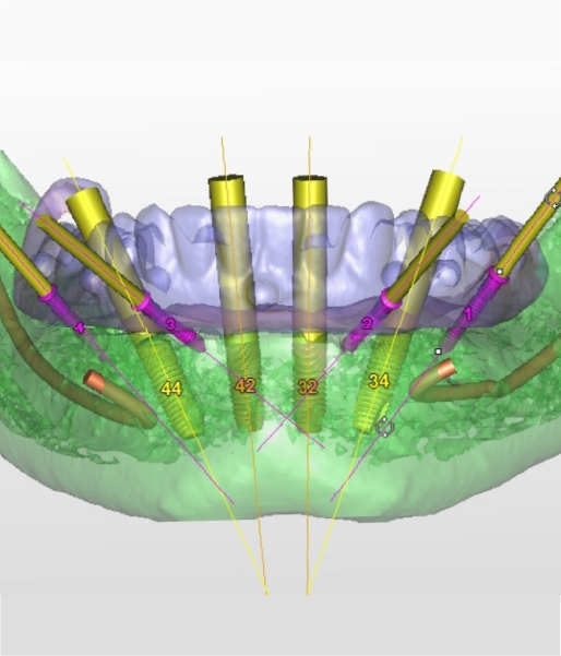 Radiología 3D