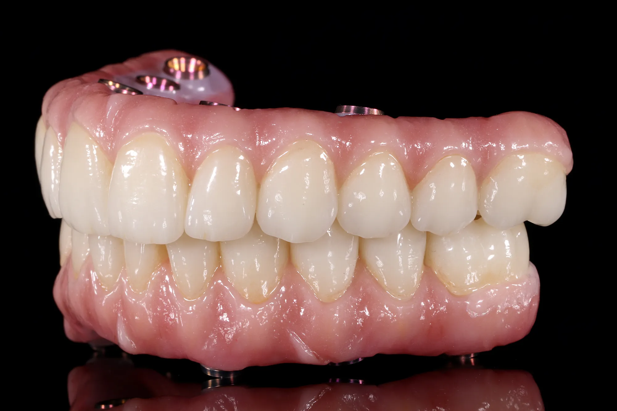 Zirconia monolítica