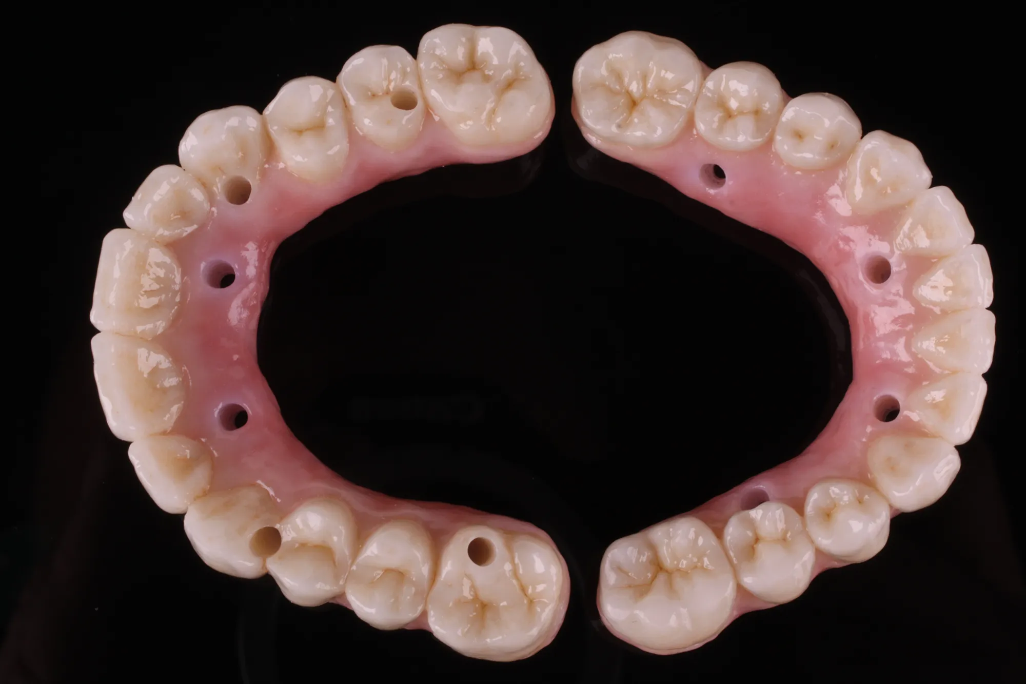 Zirconia monolítica