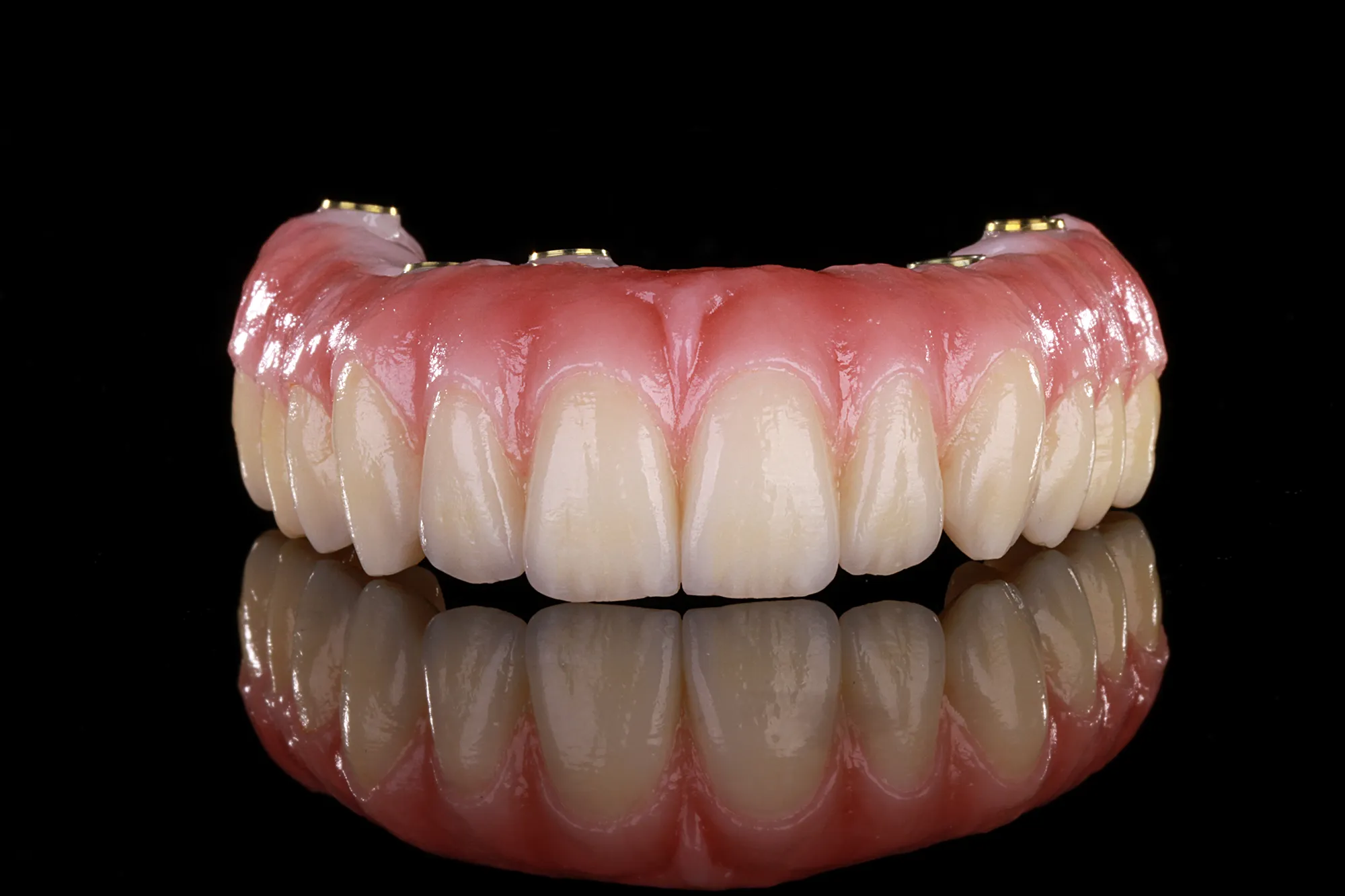 Prótesis de zirconia monolítica